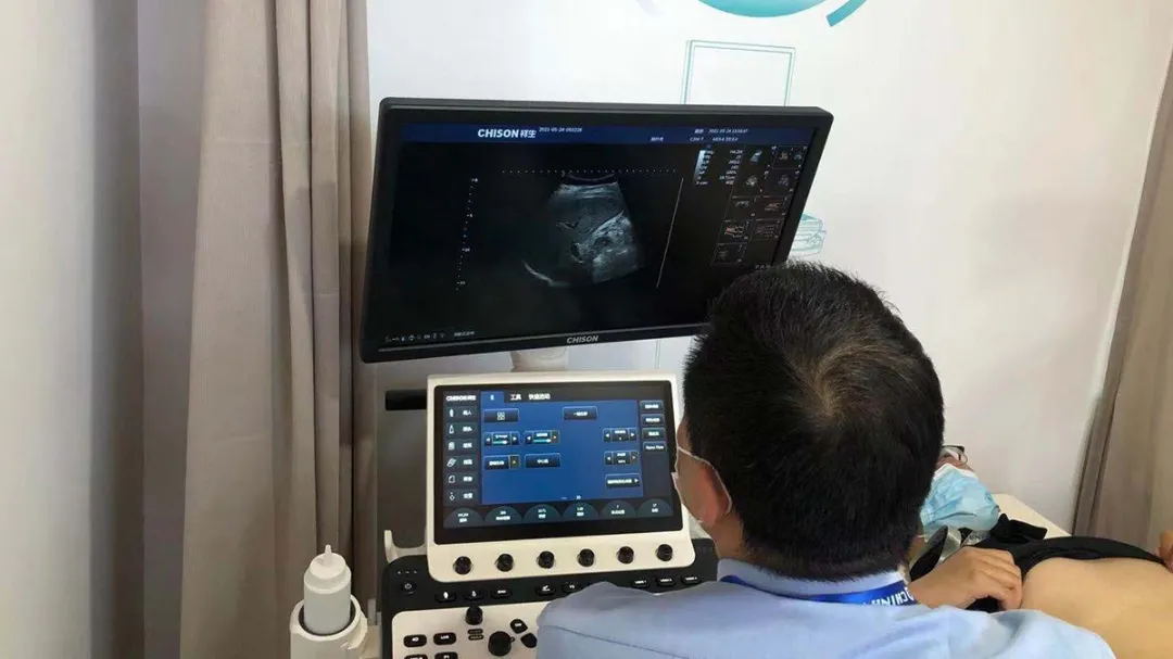 祥生医疗超声阵容掀高端智能热潮|2021 CHINA MED