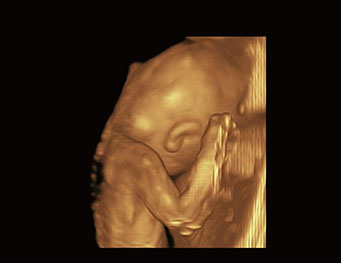 胎儿身体，4D 模式