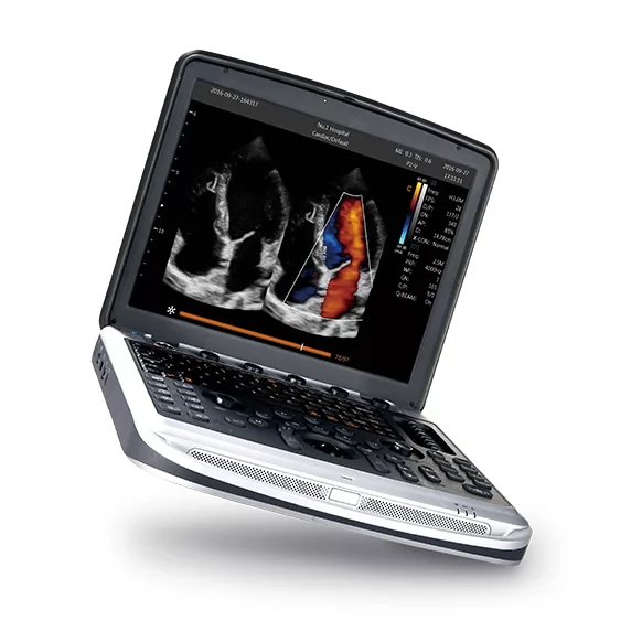 SonoBook 6