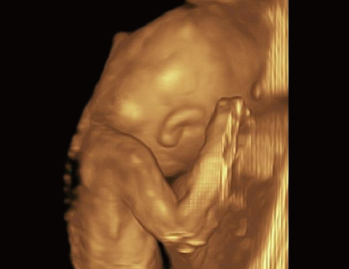 胎儿， 4D 模式