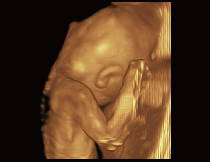 胎儿 ， 4D模式