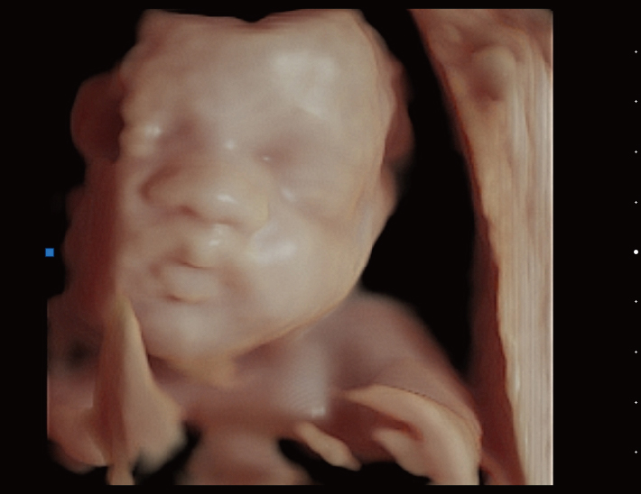 胎儿面部，高清成像