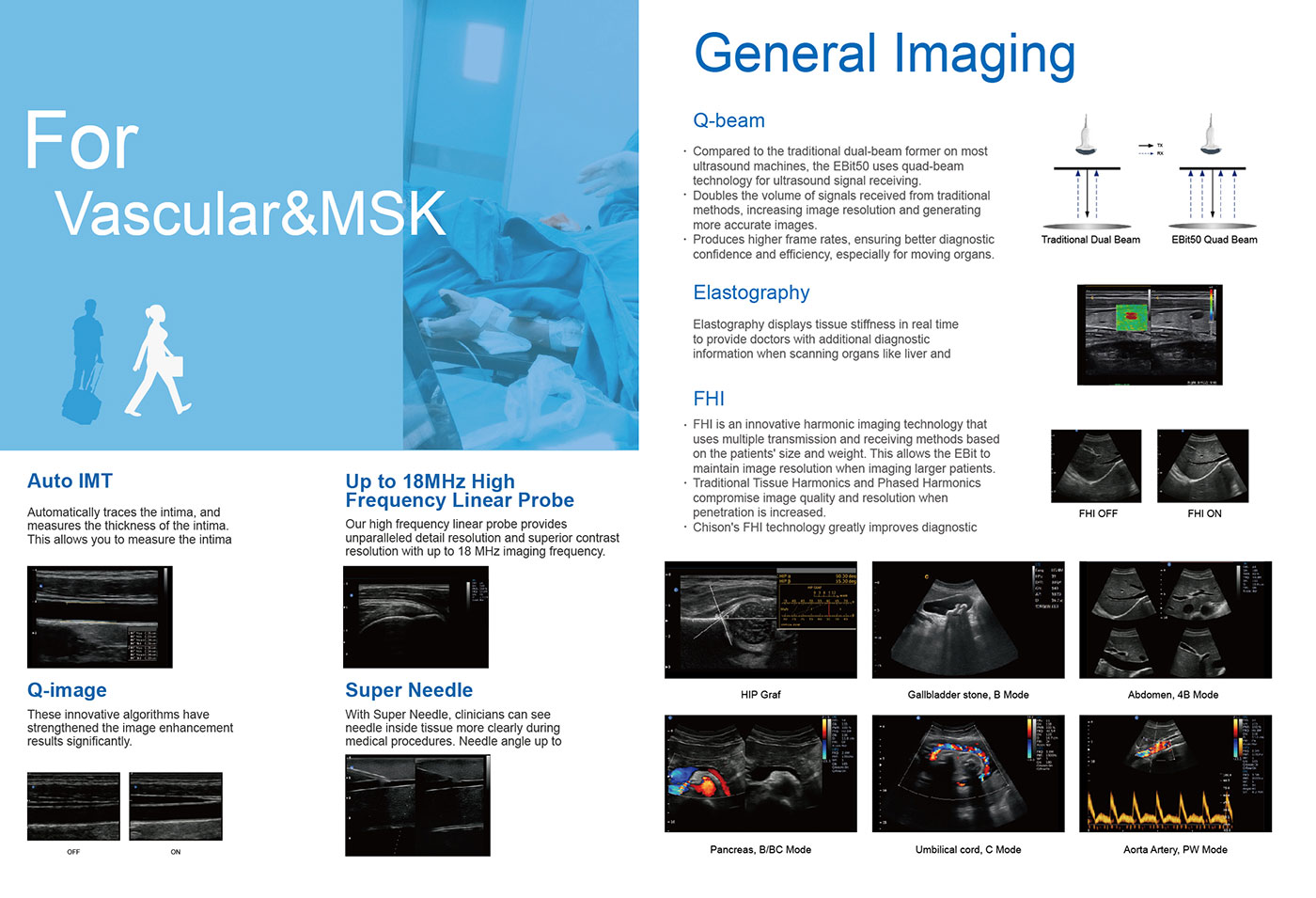 Cardiac Ultrasound Machine Features