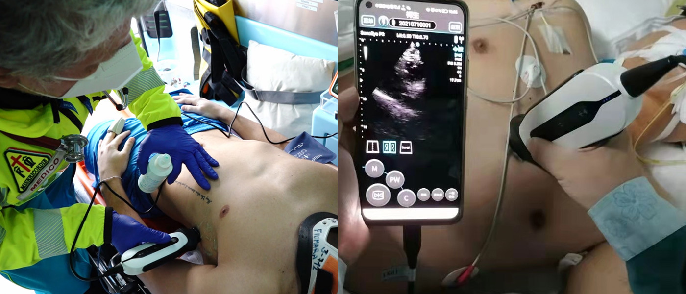 SonoEye P3 Handheld Echocardiography Machines