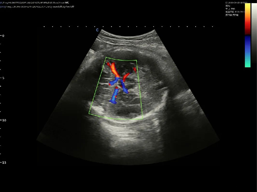 Fetal intracranial flow imaging