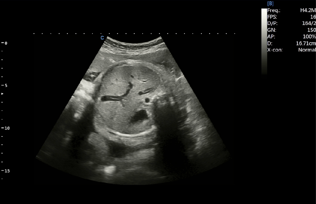 Fetal abdominal section