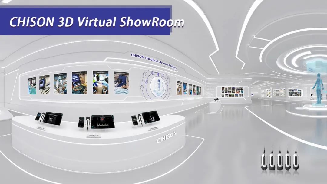 CHISON 3D Virtual ShowRoom