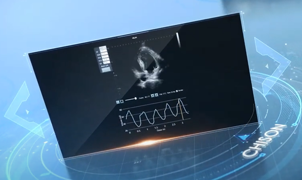 The Ultimate Guide to Cardiac Ultrasound