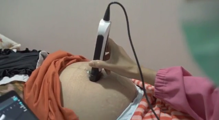 SonoEye ultrasound