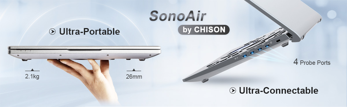 CHISON SonoAir: The Ultimate Portable Ultrasound System for Confident Diagnoses