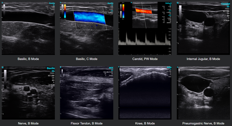 Are Handheld Ultrasounds Accurate?cid=4