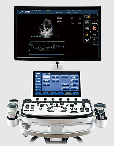 Cart-based Ultrasound
