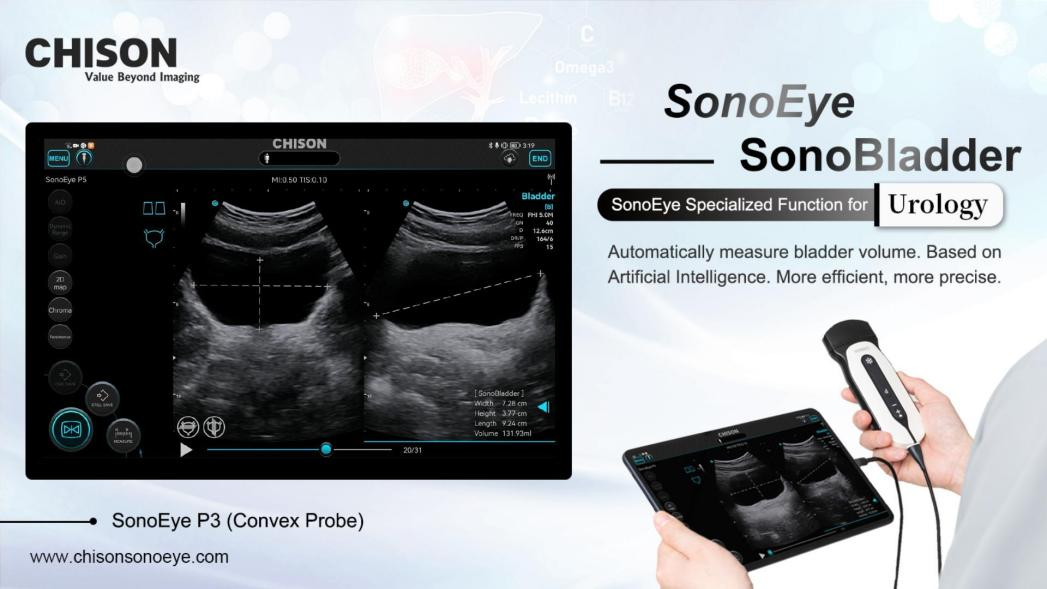 Portable Ultrasound