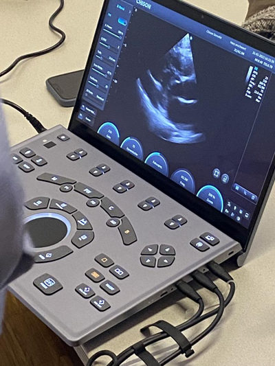 Portable Ultrasound