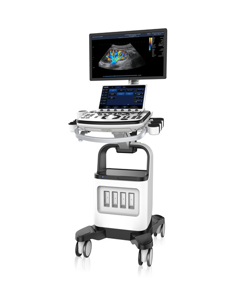 Abdominal Ultrasound