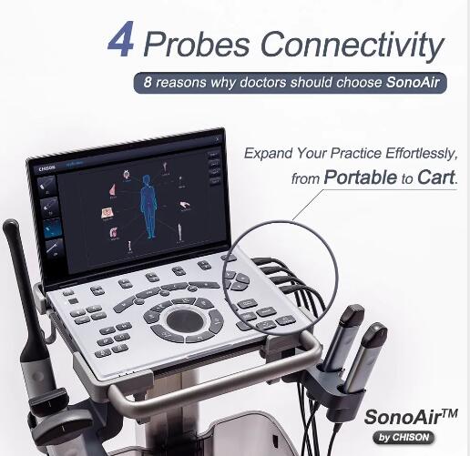 8 Reasons Doctors Should Choose SonoAir