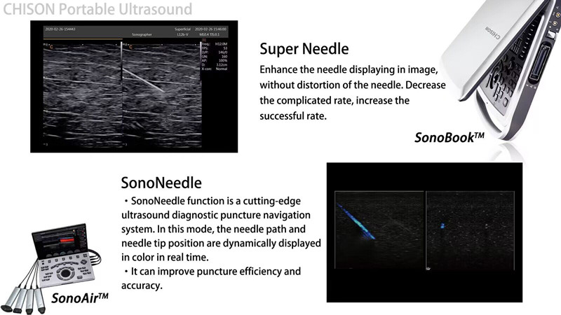Top Ten Tips for Ultrasound-Guided Joint Injections