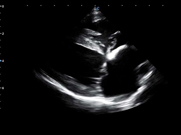 Animal Case Sharing | Myxomatous Mitral Valve Disease in Canine