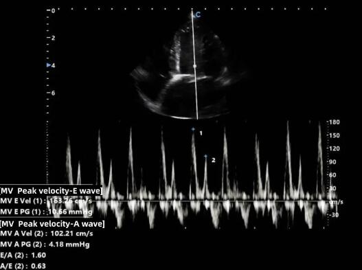 Animal Case Sharing | Myxomatous Mitral Valve Disease in Canine