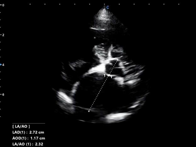 Animal Case Sharing | Myxomatous Mitral Valve Disease in Canine