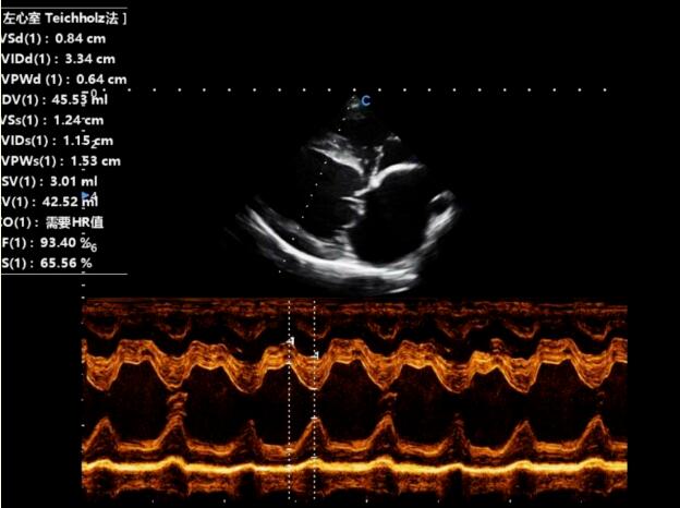 Animal Case Sharing | Myxomatous Mitral Valve Disease in Canine