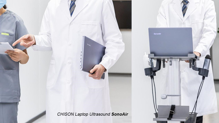 Choosing the Right MSK Ultrasound Machine