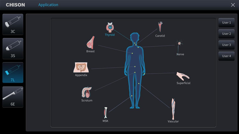 SonoAir’s 3D interface