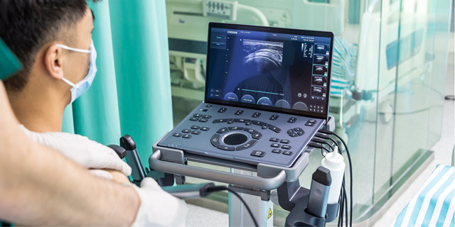 Revolutionize Point-of-Care with Portable MSK Ultrasound Devices