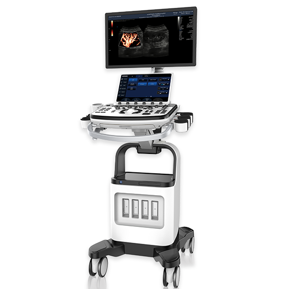 Is Cart-based Ultrasound the Best Choice for Multi-Department Use?