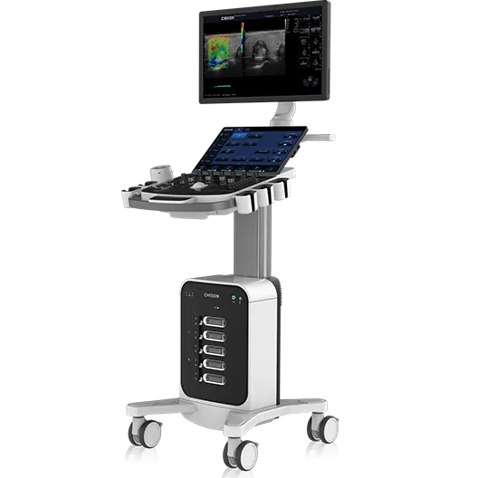The Critical Role of Cart-Based Ultrasound in Saving Lives During Emergency Medical Situations