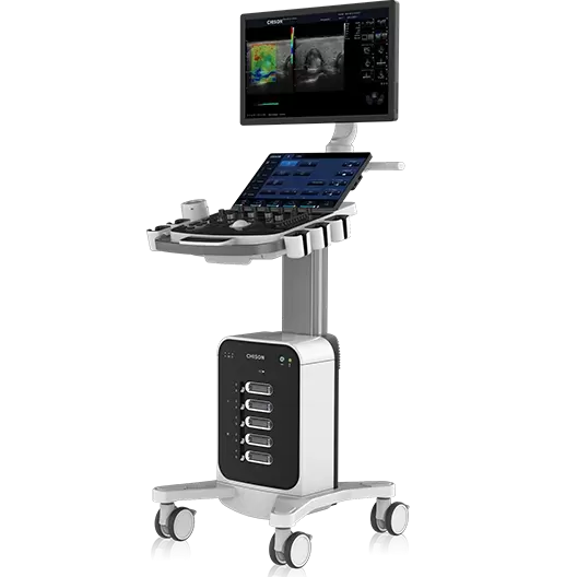 The Critical Role of Cart-Based Ultrasound in Saving Lives During Emergency Medical Situations