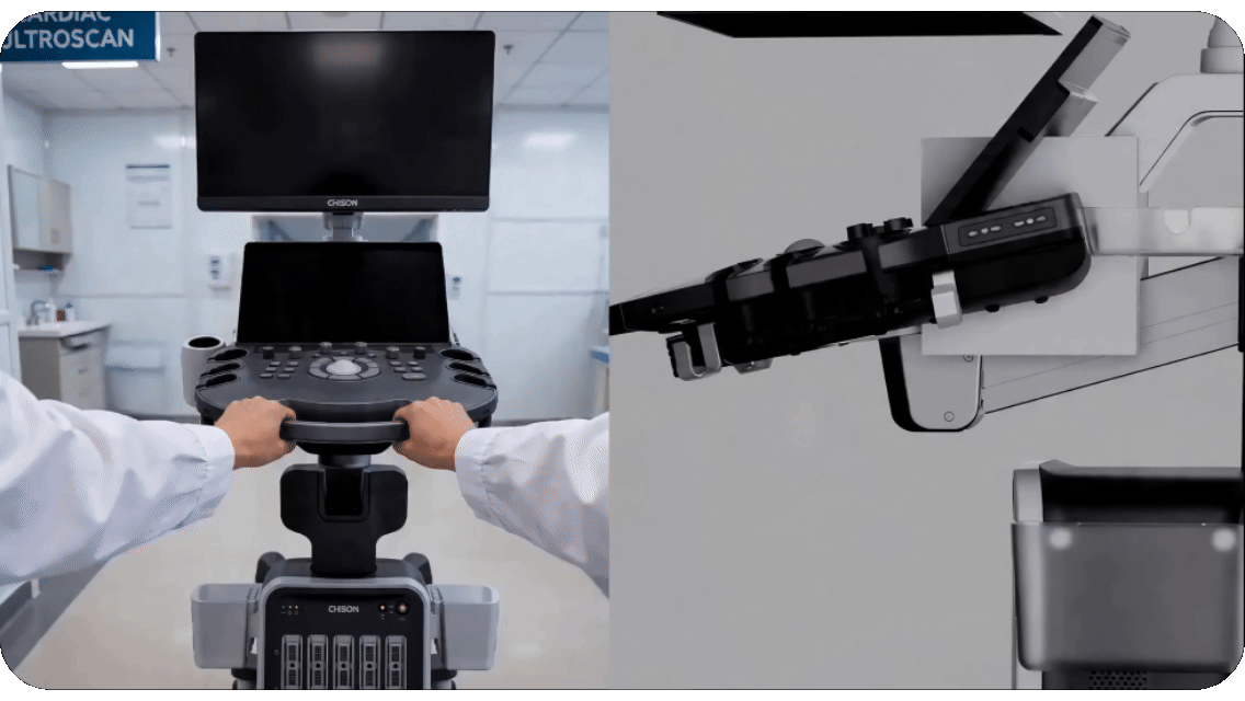 CHISON SonoPort | New Generation intelligent Cart-based Ultrasound System