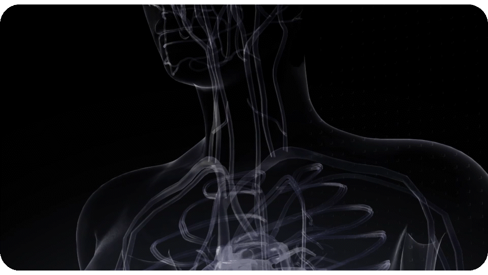 CHISON SonoPort | New Generation intelligent Cart-based Ultrasound System