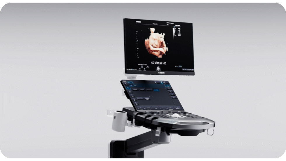 CHISON SonoPort | New Generation intelligent Cart-based Ultrasound System