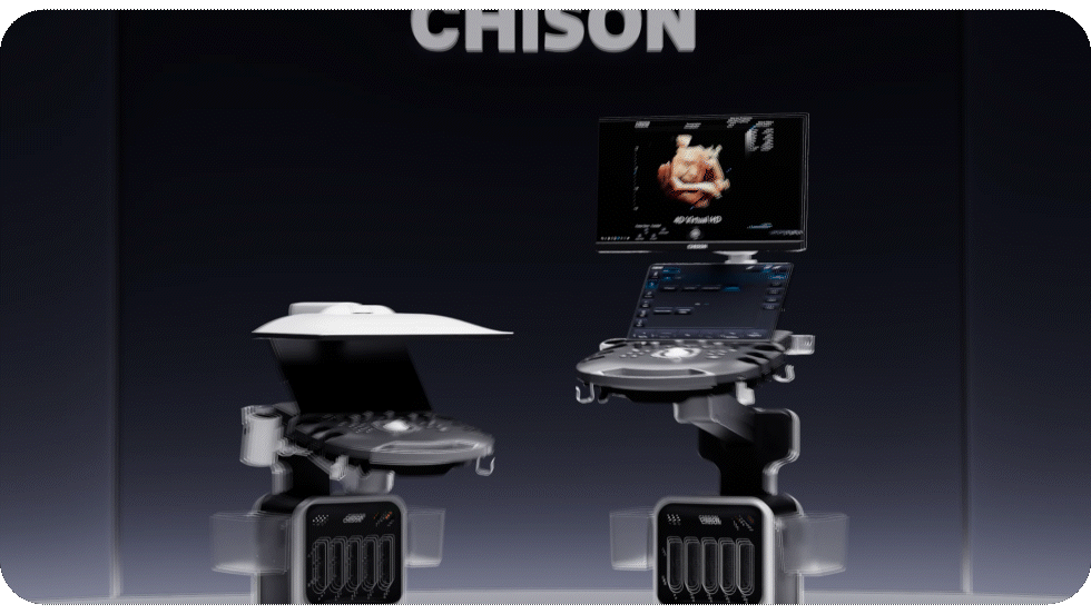 CHISON SonoPort | New Generation intelligent Cart-based Ultrasound System