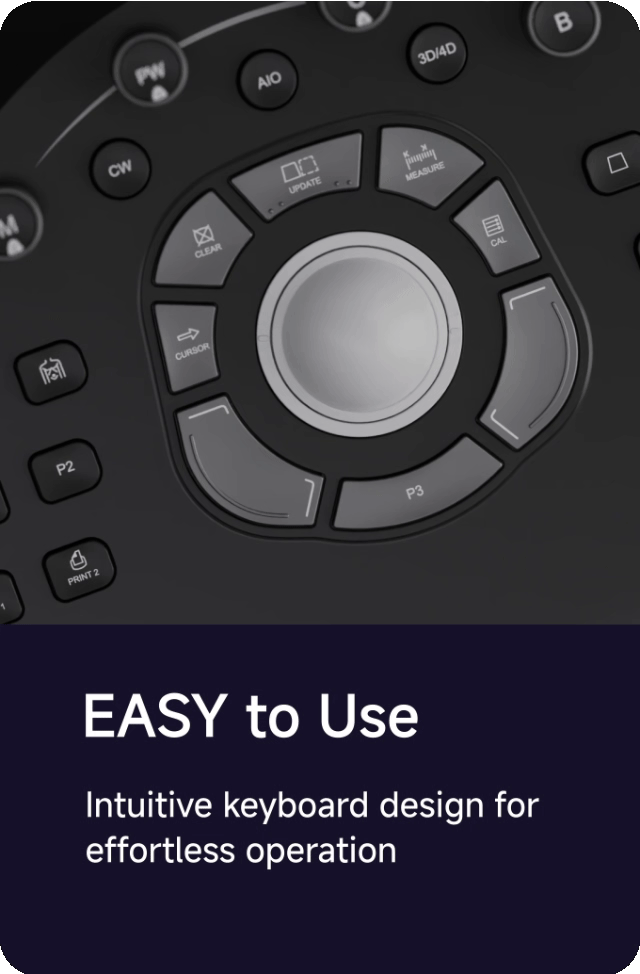 CHISON SonoPort | New Generation intelligent Cart-based Ultrasound System