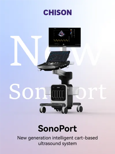 CHISON SonoPort | New Generation intelligent Cart-based Ultrasound System
