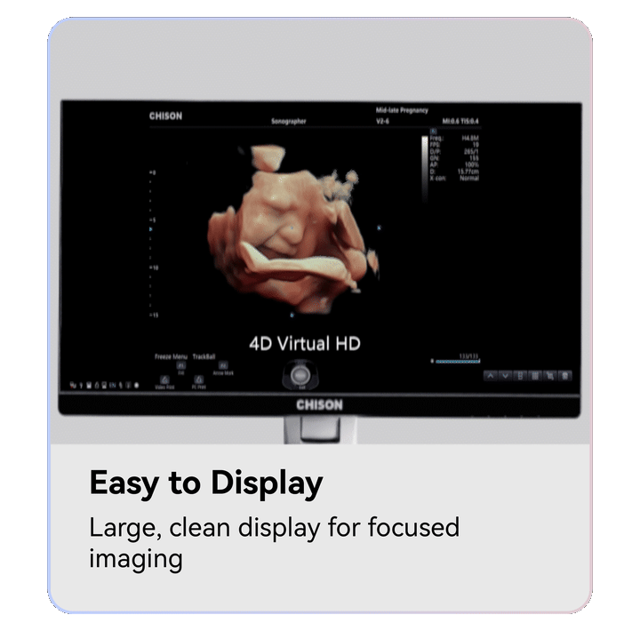 CHISON SonoPort | New Generation intelligent Cart-based Ultrasound System