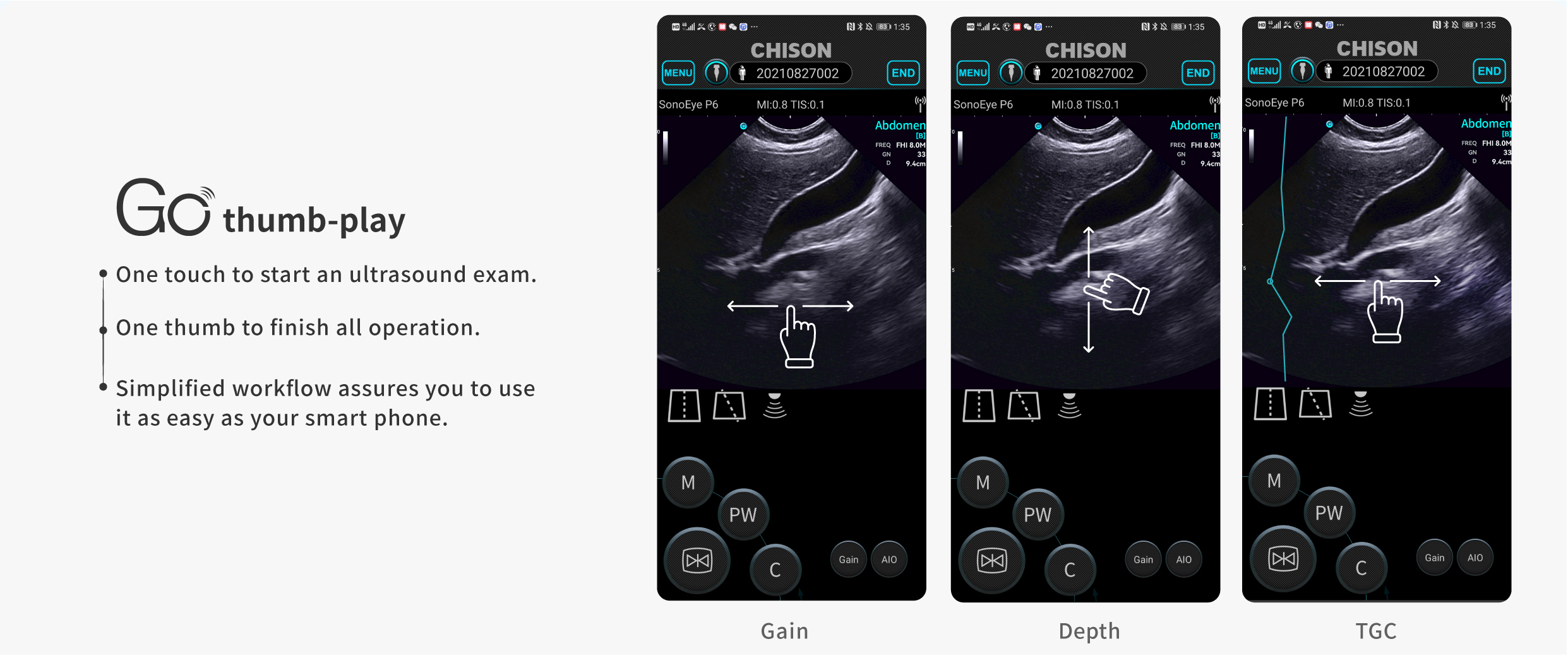 What Defines an Effective Handheld Ultrasound System in the Era of POCUS?cid=67 What Defines an Effective Handheld Ultrasound System in the Era of POCUS?cid=67