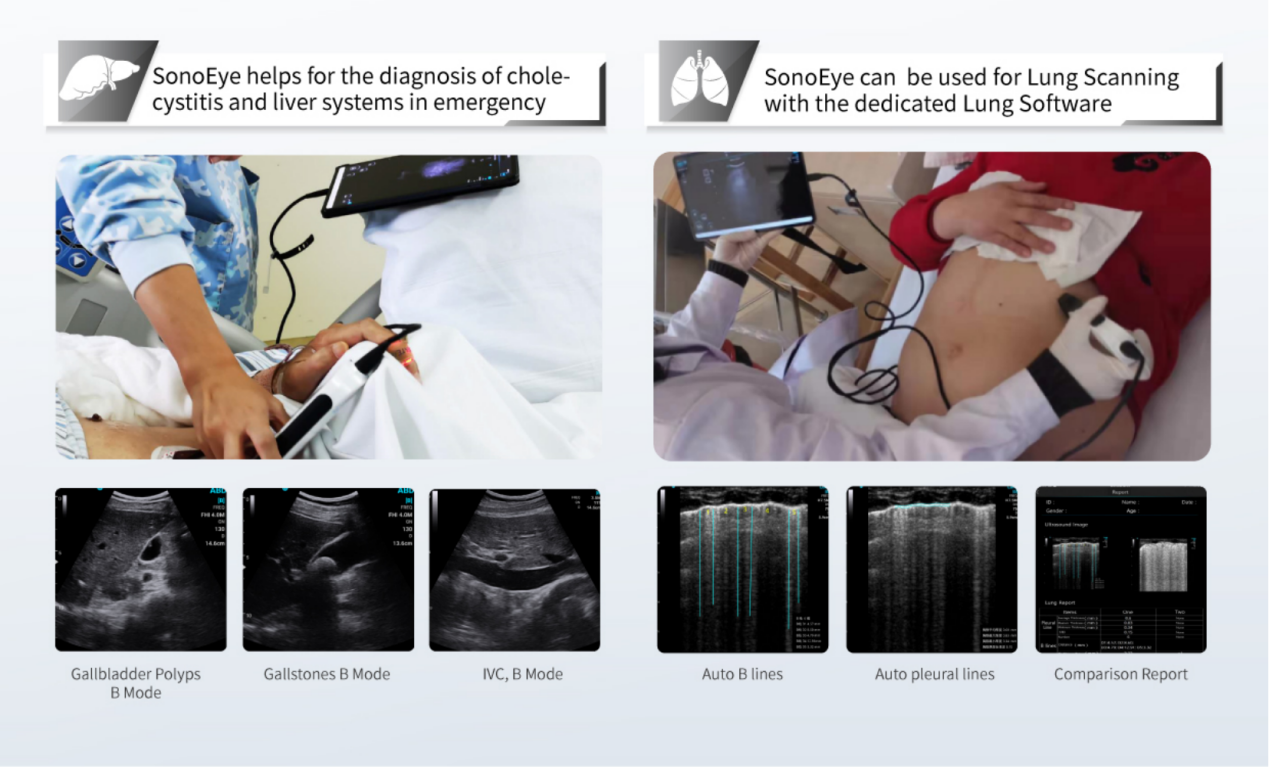 What Defines an Effective Handheld Ultrasound System in the Era of POCUS?cid=67 What Defines an Effective Handheld Ultrasound System in the Era of POCUS?cid=67