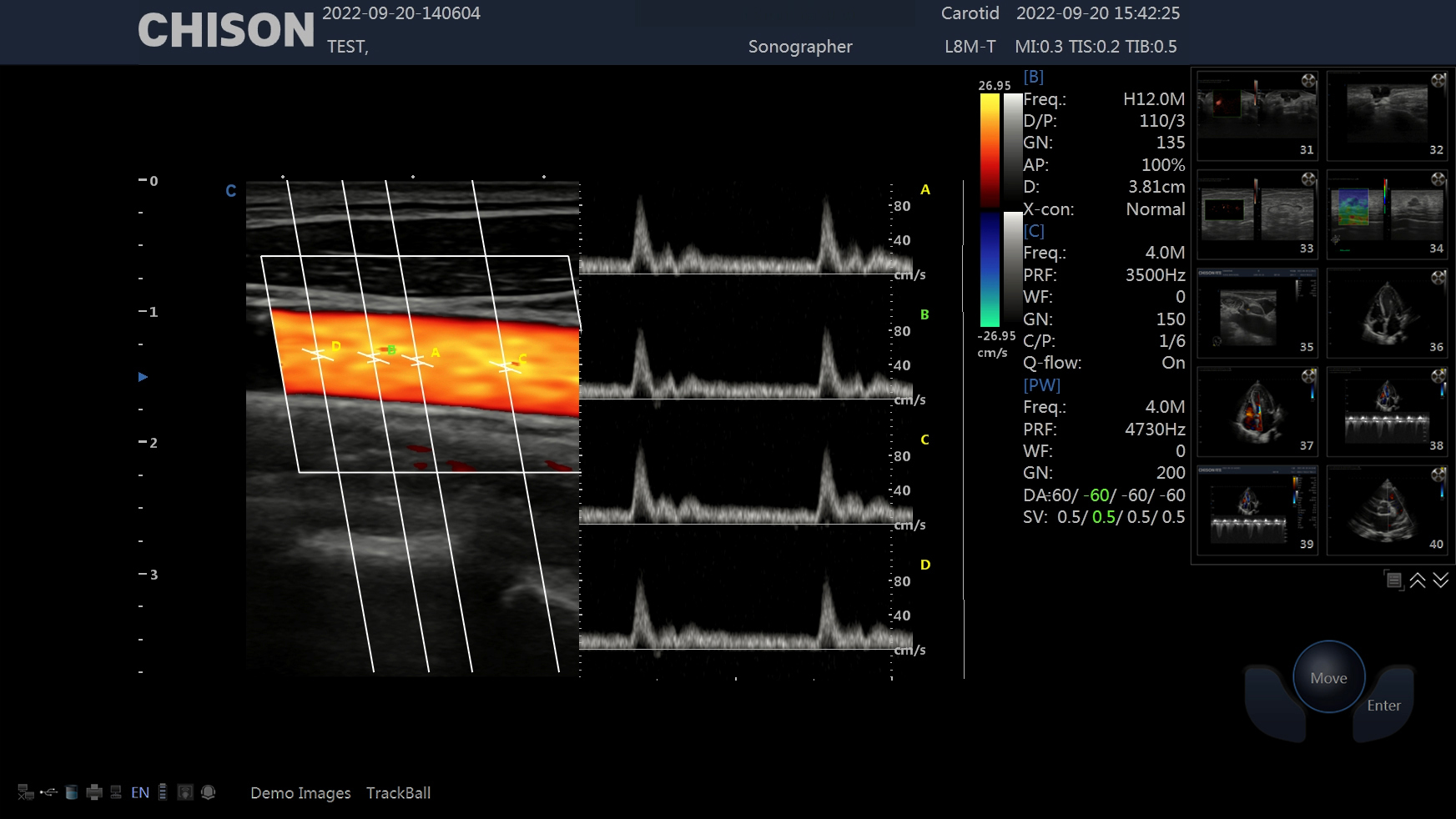 From Imaging to Clinical Decisions From Imaging to Clinical Decisions