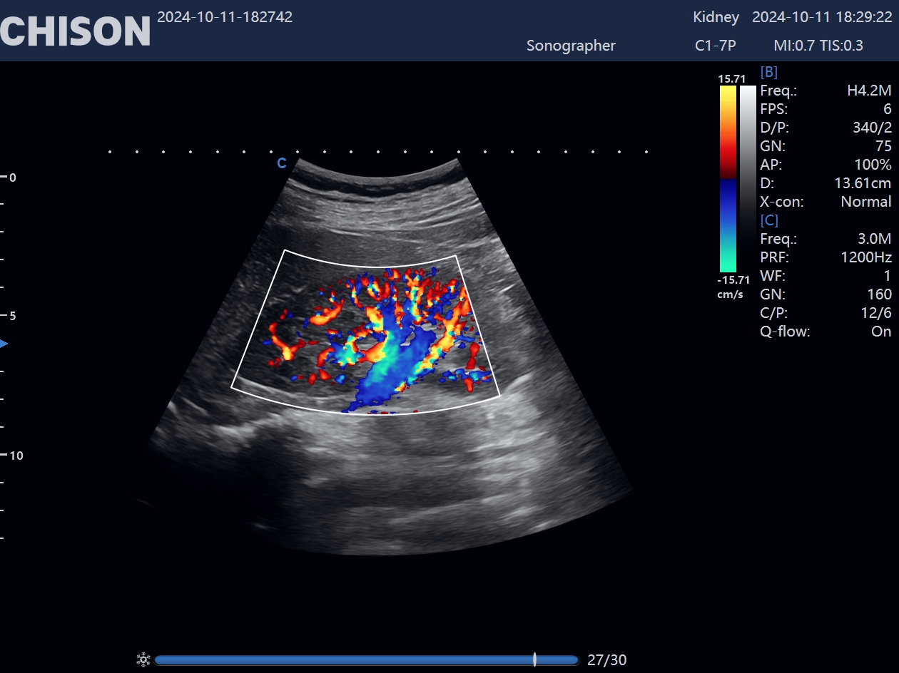 From Imaging to Clinical Decisions From Imaging to Clinical Decisions