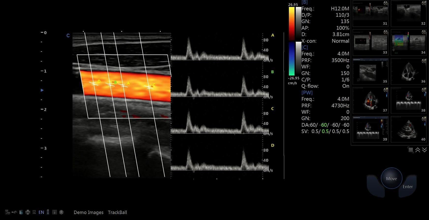 From Imaging to Clinical Decisions From Imaging to Clinical Decisions