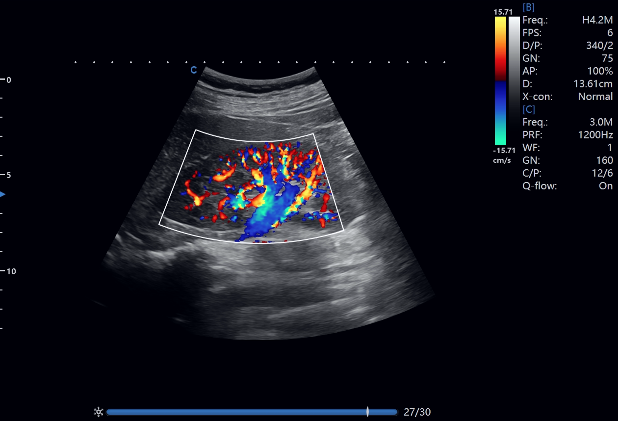 From Imaging to Clinical Decisions From Imaging to Clinical Decisions