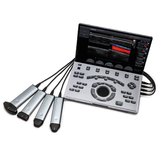 Portable Ultrasound Buying Guide for Rehabilitation Centers