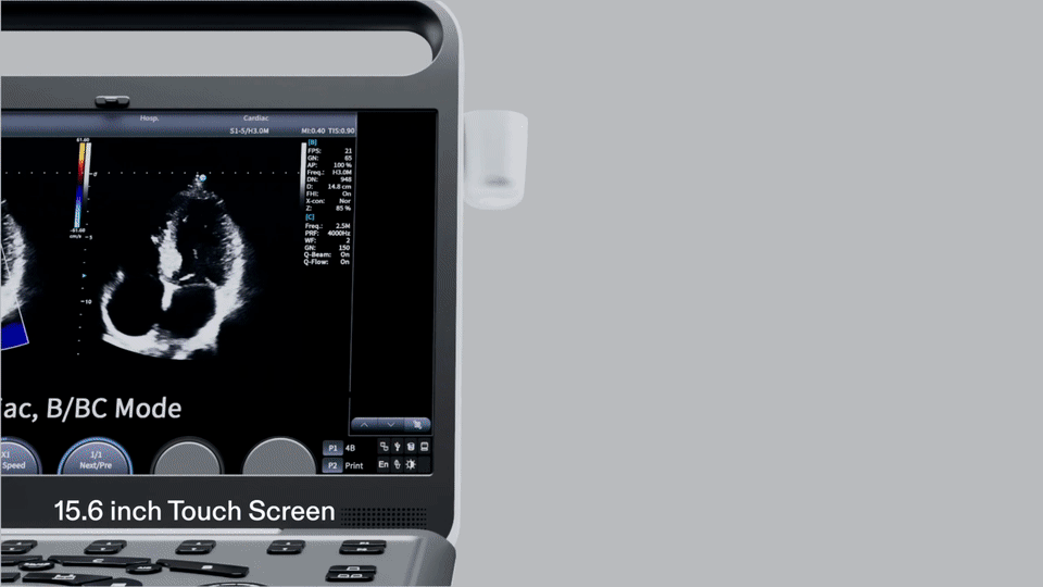 Meet SonoGO: The World’s First Three-in-One Ultrasound System Meet SonoGO: The World’s First Three-in-One Ultrasound System