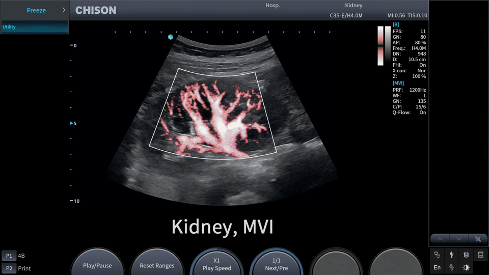Meet SonoGO: The World’s First Three-in-One Ultrasound System Meet SonoGO: The World’s First Three-in-One Ultrasound System