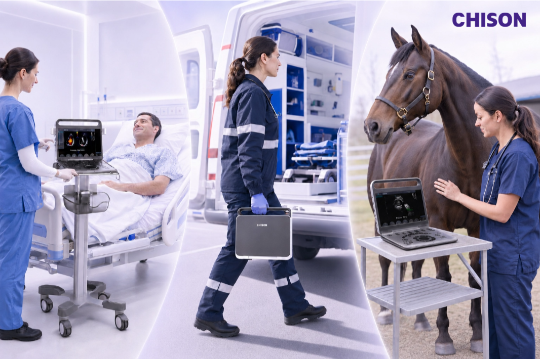 Meet SonoGO: The World’s First Three-in-One Ultrasound System Meet SonoGO: The World’s First Three-in-One Ultrasound System