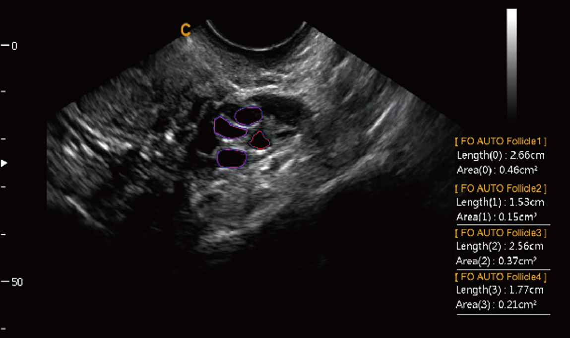 What Is a 3-in-1 Ultrasound System—and How Does It Improve Clinical Workflow?cid=67