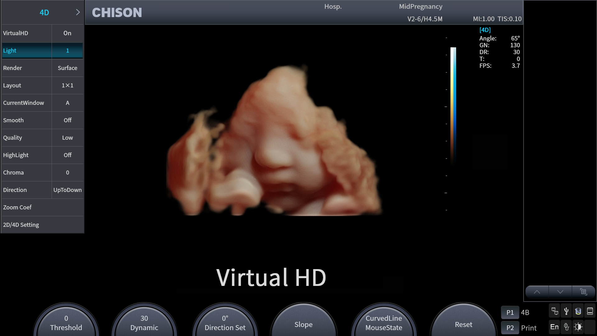 What Is a 3-in-1 Ultrasound System—and How Does It Improve Clinical Workflow?cid=67